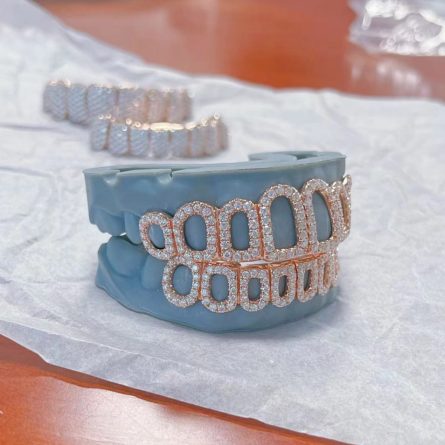 Amazon'S Best Selling Hip-Hop Braces Teeth Hiphop Hollow S925 Sterling Silver Micro-Set Moissan Diamond Rose Gold Braces - Image 3