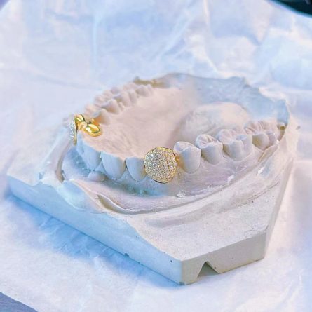 S925 Sterling Silver Moissan Diamond Braces European And American Hip-Hop Style Hippop Tiger Teeth Braces Fashion Trendy Products - Image 3