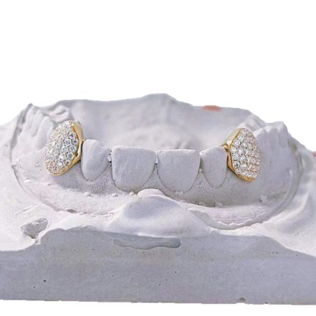 S925 Sterling Silver Moissan Diamond Braces European And American Hip-Hop Style Hippop Tiger Teeth Braces Fashion Trendy Products - Image 5