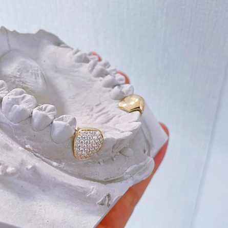 S925 Sterling Silver Moissan Diamond Braces European And American Hip-Hop Style Hippop Tiger Teeth Braces Fashion Trendy Products - Image 4
